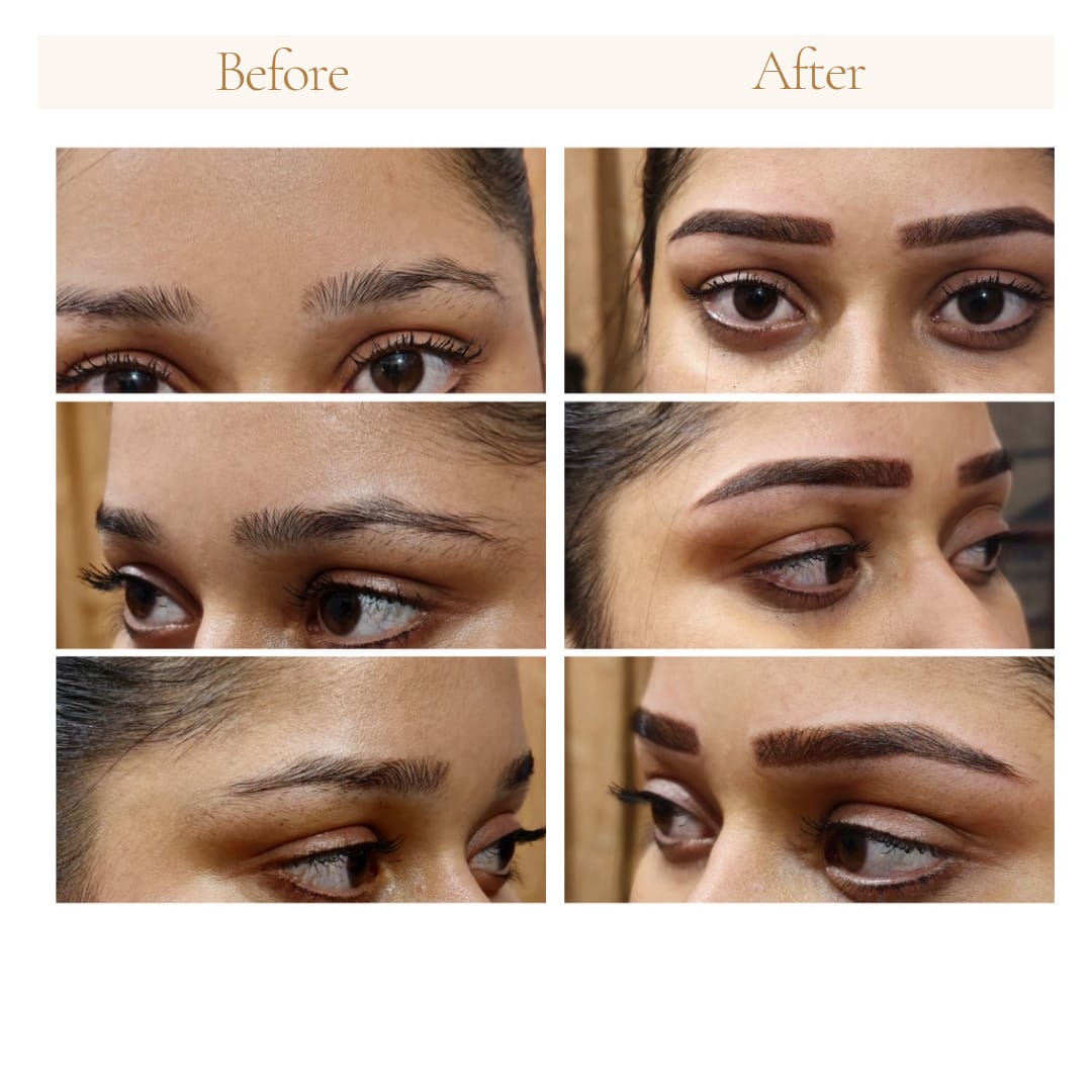Before and after treatment comparison